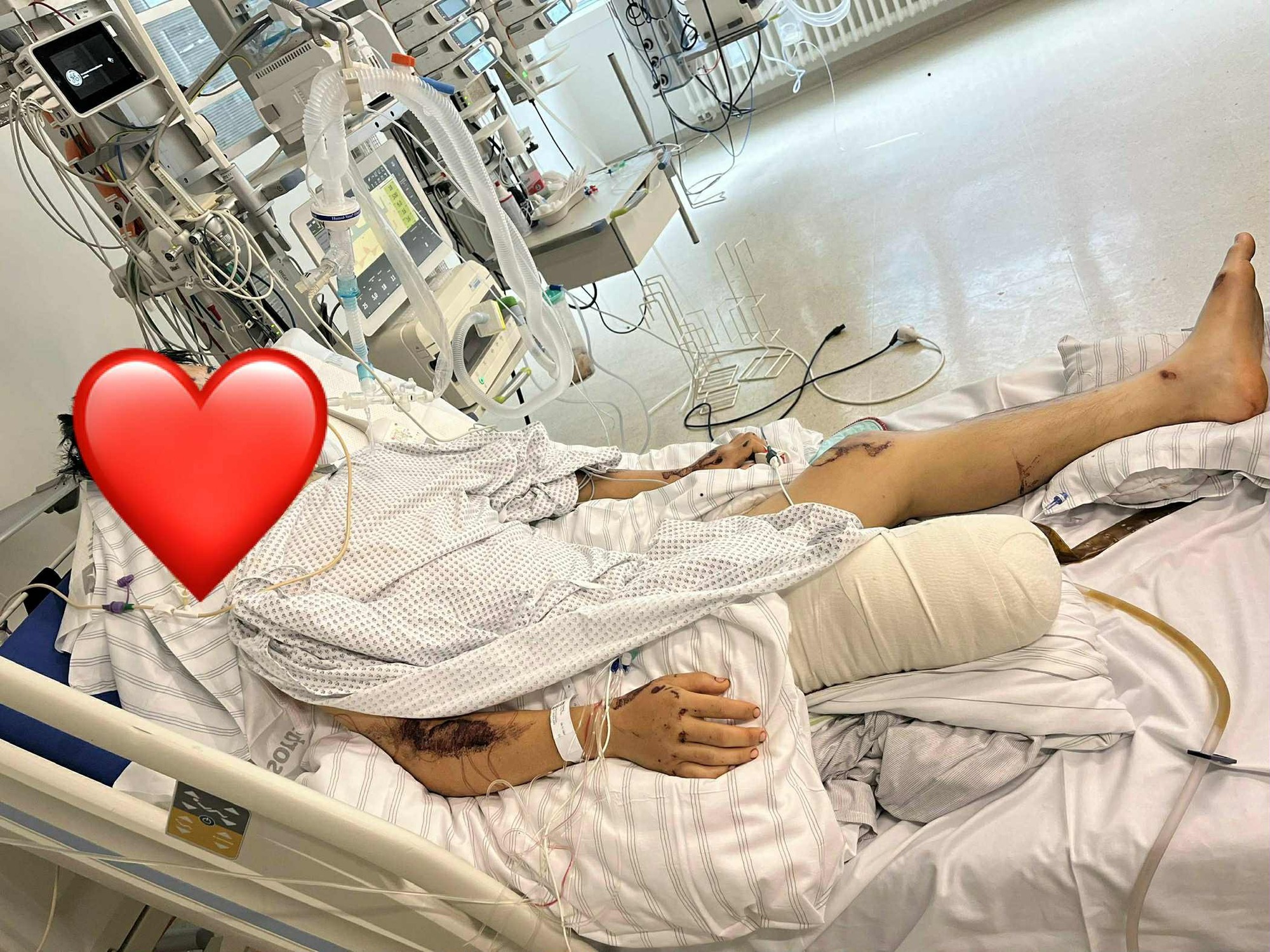Tai nạn thương tâm tại Đức: Hai du học sinh Việt Nam mất mạng, một người nguy kịch - Ảnh 2.